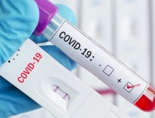 253 са новите случаи на коронавирус